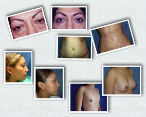 Collage de cambios