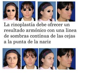 Armonía líneas de Sheen