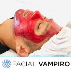 Facial vampiro