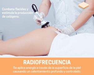 Radiofrecuencia