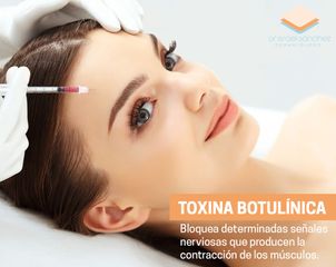 Toxina Botulínica