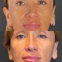 Tratamientos faciales - Dra. Monica Isabel Prieto Bautista, Nova House