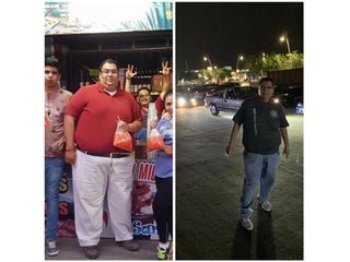 Antes y después de Manga Gástrica