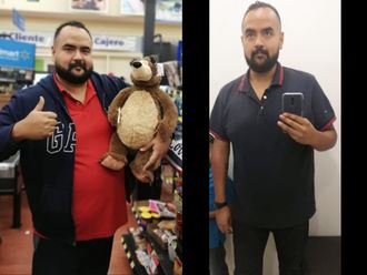 Bypass Gástrico antes y después - 639726