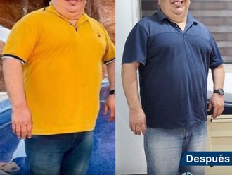Manga Gástrica antes y después - 840840