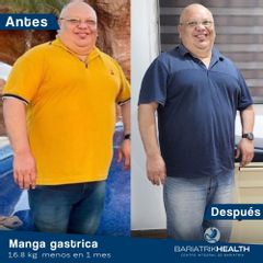 Manga gástrica - Dr. Daniel Alberto Zepeda González