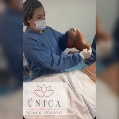 Abdominoplastia