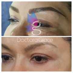 Microblading - BelléMedic