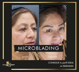 Microblading - Doctora Grace