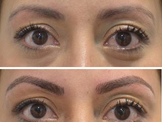 Antes y después de Microblading