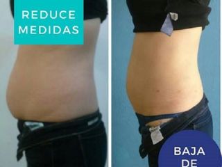 Antes y después de control de peso