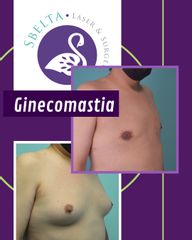 Ginecomastia - Dra. Jessica Ramírez Cadena