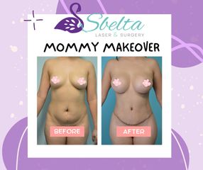 Mommy Makeover - Dra. Jessica Ramírez Cadena