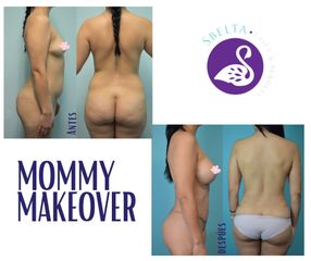 Mommy Makeover - Dra. Jessica Ramírez Cadena