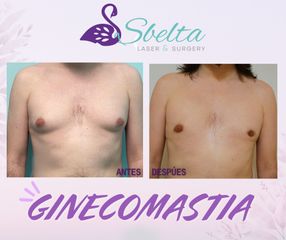 Ginecomastia - Dra. Jessica Ramírez Cadena