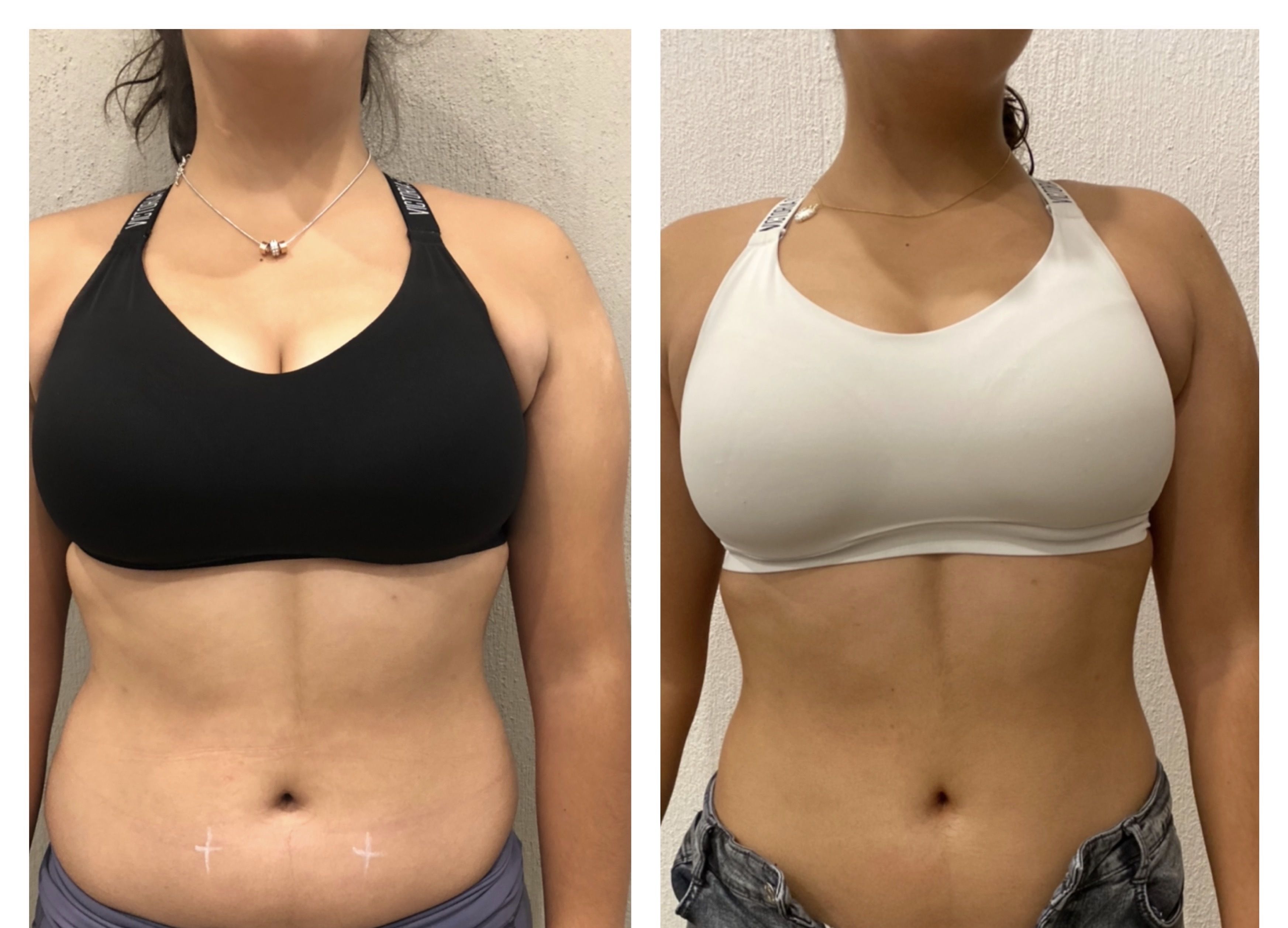 Resultado Microblading Detalle