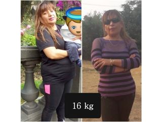 Antes y después de Control de peso