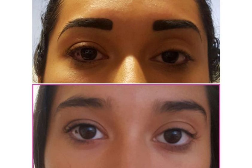 Micropigmentación antes y después - 639559