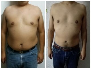 Antes y después (1 mes)