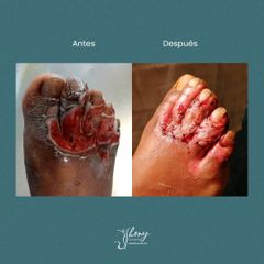 Cirugía reconstructiva - Dr. Jhony Camarero