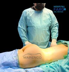 Gluteoplastia