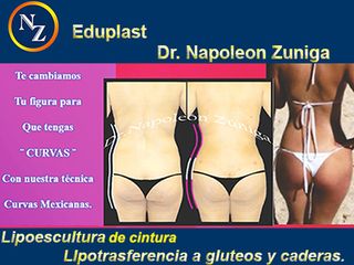 Curvas Mexicanas. Marca Registrada de Dr. Napoleón Zúñiga
