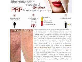 Antes y después de Plasma rico en plaquetas