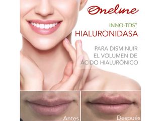 Antes y después de disminución de labios