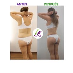 Lipoescultura 4D VHD 