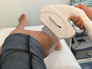 Depilación permanente