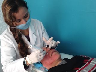 Aplicación Plasma Dermapen