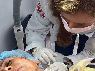 Rejuvenecimiento facial 
