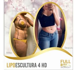 Antes y después de Lipoescultura