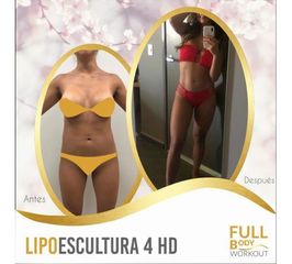 Antes y después de Lipoescultura