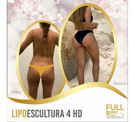 Lipoescultura