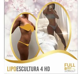 Antes y después de Lipoescultura