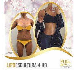 Antes y después de Lipoescultura