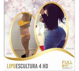 Antes y después de Lipoescultura