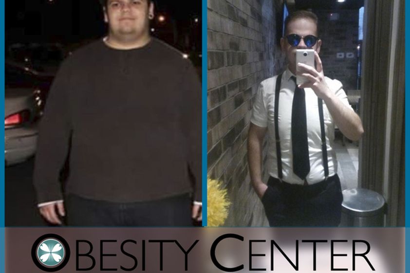 Bypass Gástrico antes y después - 535415
