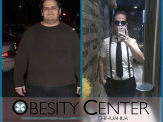 Antes y después Obesity Center Chihuahua
