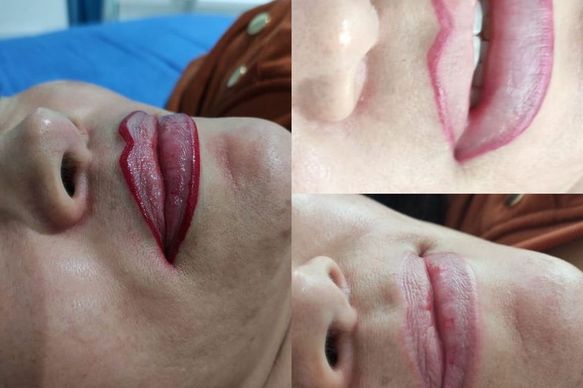 Micropigmentación antes y después - 800576