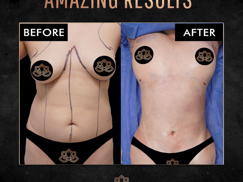 Vive Plastic Surgery Multiestetica.mx