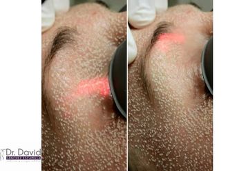 Tratamientos faciales - 632662