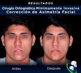 Cirugía maxilofacial - Dr. Ricardo Guillén