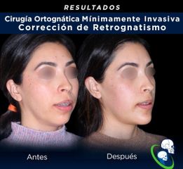 Cirugía maxilofacial - Dr. Ricardo Guillén