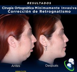 Cirugía maxilofacial - Dr. Ricardo Guillén