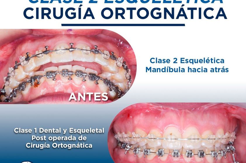 Cirugía maxilofacial antes y después - 839176