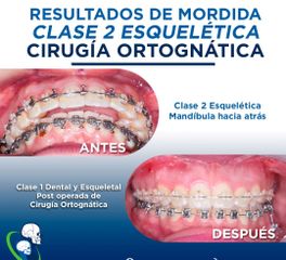 Cirugía maxilofacial - Dr. Ricardo Guillén