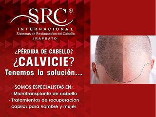 Soluciones a la pérdida de cabello