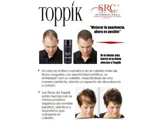 Soluciones a la pérdida de cabello